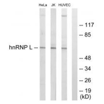 Western blot - hnRNP L Antibody from Signalway Antibody (33682) - Antibodies.com