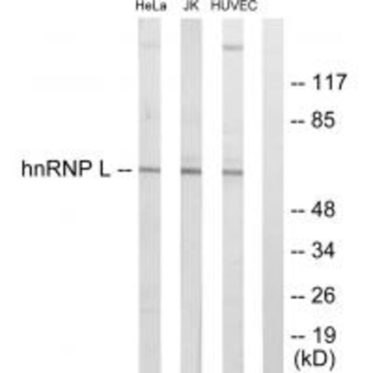 Western blot - hnRNP L Antibody from Signalway Antibody (33682) - Antibodies.com