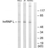 Western blot - hnRNP L Antibody from Signalway Antibody (33682) - Antibodies.com