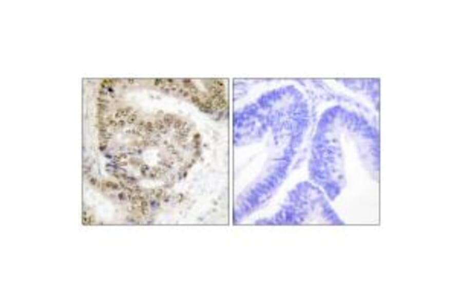 Immunohistochemistry - hnRNP L Antibody from Signalway Antibody (33682) - Antibodies.com