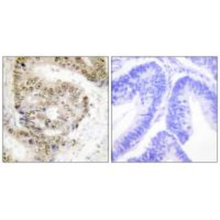 Immunohistochemistry - hnRNP L Antibody from Signalway Antibody (33682) - Antibodies.com