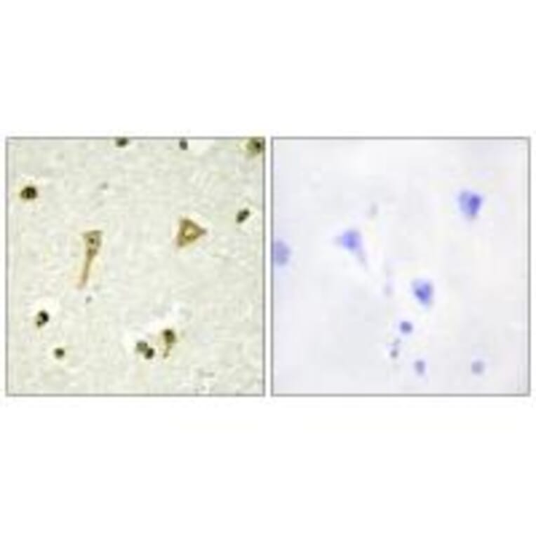 Immunohistochemistry - TSC22D1 Antibody from Signalway Antibody (33905) - Antibodies.com