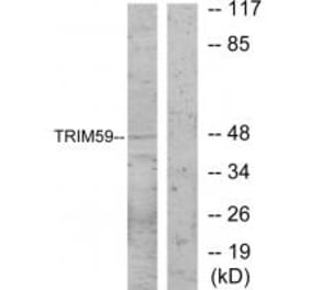 Western blot - TRIM59 Antibody from Signalway Antibody (33960) - Antibodies.com