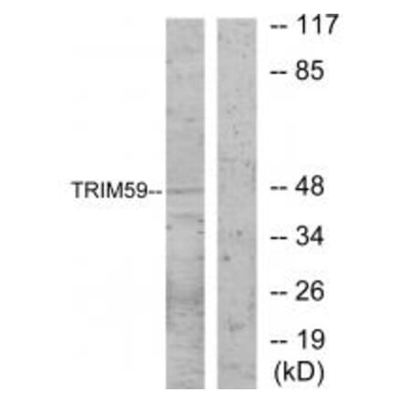Western blot - TRIM59 Antibody from Signalway Antibody (33960) - Antibodies.com