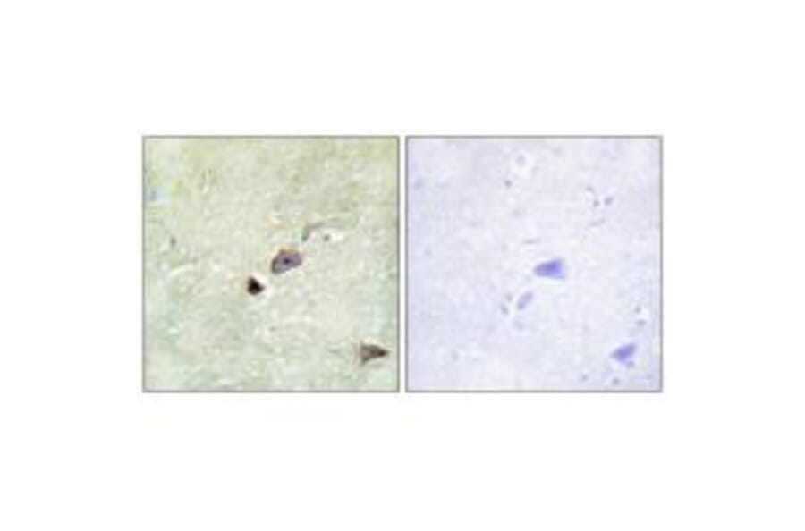 Immunohistochemistry - TRIM59 Antibody from Signalway Antibody (33960) - Antibodies.com