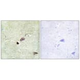 Immunohistochemistry - TRIM59 Antibody from Signalway Antibody (33960) - Antibodies.com