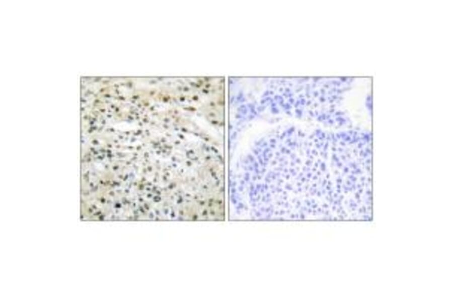 Immunohistochemistry - DNMT3B Antibody from Signalway Antibody (34091) - Antibodies.com