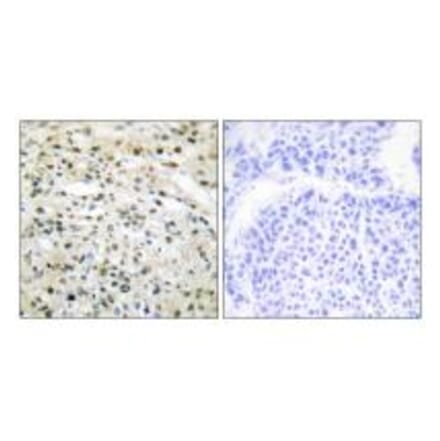 Immunohistochemistry - DNMT3B Antibody from Signalway Antibody (34091) - Antibodies.com