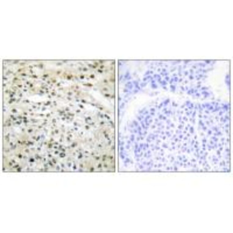 Immunohistochemistry - DNMT3B Antibody from Signalway Antibody (34091) - Antibodies.com