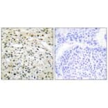 Immunohistochemistry - DNMT3B Antibody from Signalway Antibody (34091) - Antibodies.com