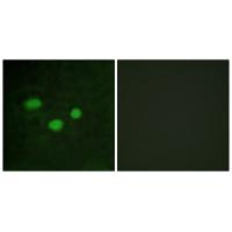 Immunofluorescence - DNMT3B Antibody from Signalway Antibody (34091) - Antibodies.com