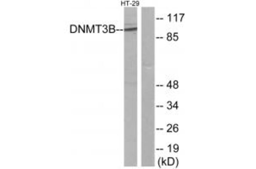 Western blot - DNMT3B Antibody from Signalway Antibody (34091) - Antibodies.com