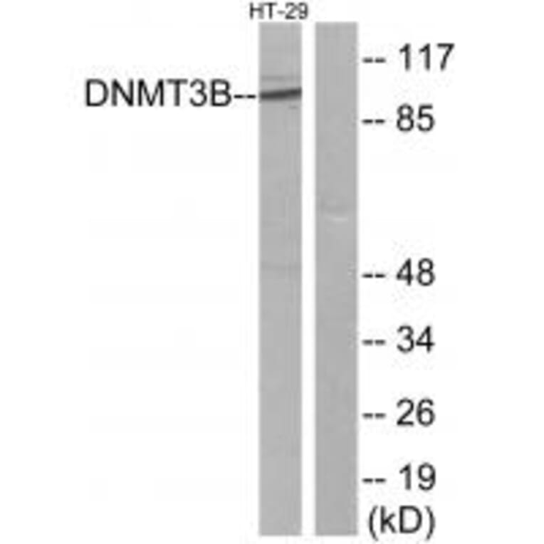 Western blot - DNMT3B Antibody from Signalway Antibody (34091) - Antibodies.com