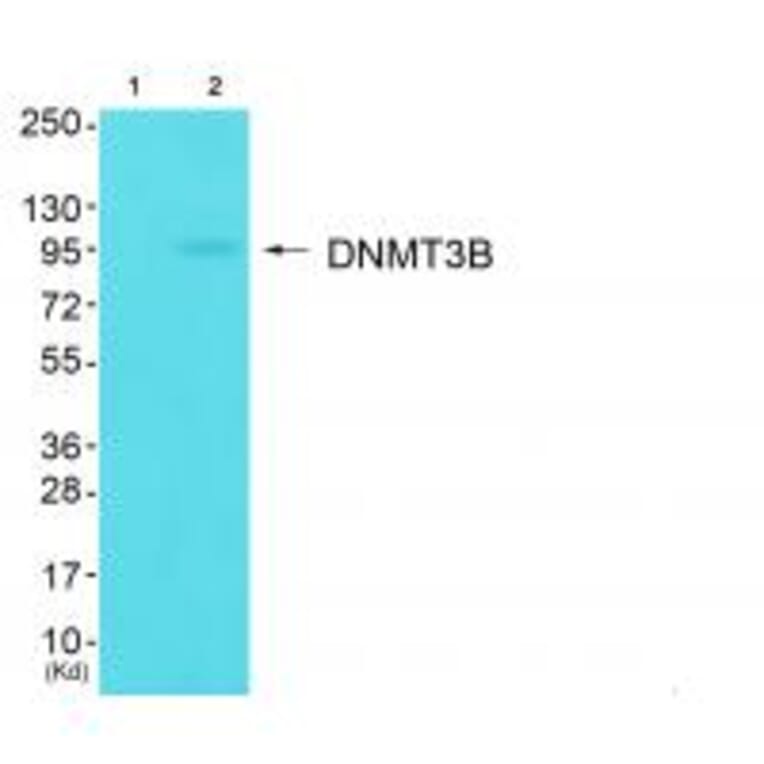 Western blot - DNMT3B Antibody from Signalway Antibody (34091) - Antibodies.com