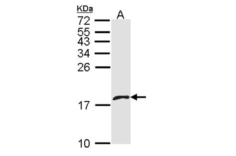 platelet factor 4 variant 1 antibody from Signalway Antibody (23051) - Antibodies.com