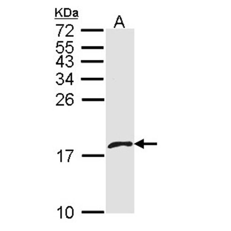 platelet factor 4 variant 1 antibody from Signalway Antibody (23051) - Antibodies.com