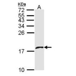 platelet factor 4 variant 1 antibody from Signalway Antibody (23051) - Antibodies.com