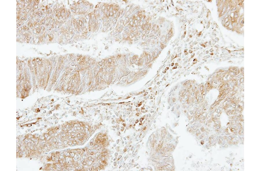 Immunohistochemistry - platelet factor 4 variant 1 antibody from Signalway Antibody (23051) - Antibodies.com