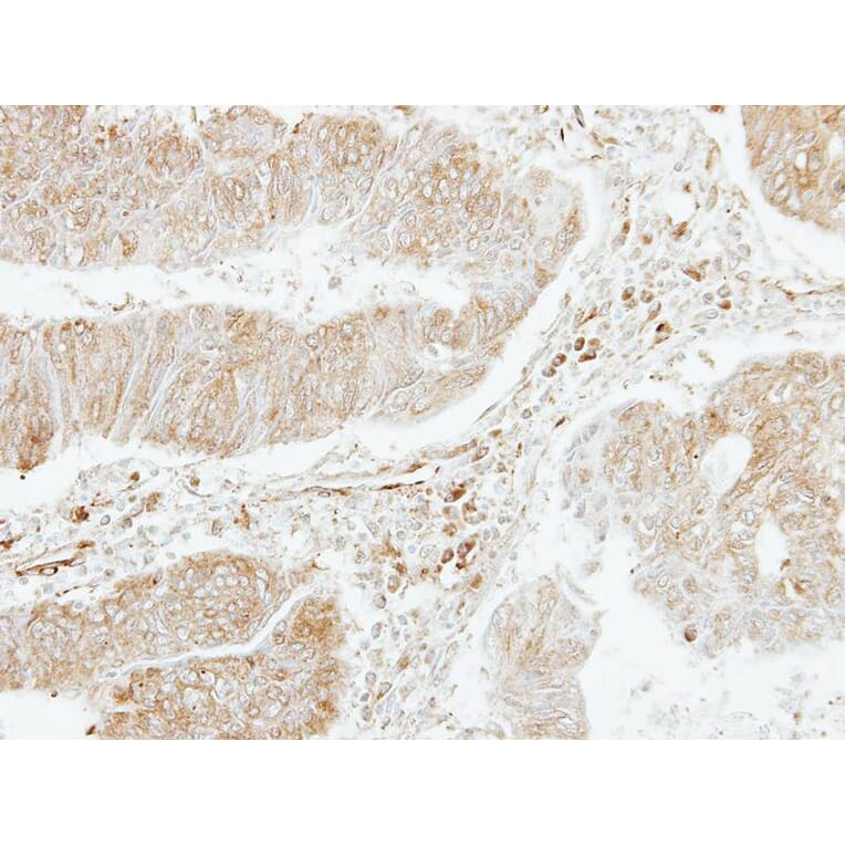 Immunohistochemistry - platelet factor 4 variant 1 antibody from Signalway Antibody (23051) - Antibodies.com