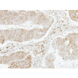 Immunohistochemistry - platelet factor 4 variant 1 antibody from Signalway Antibody (23051) - Antibodies.com