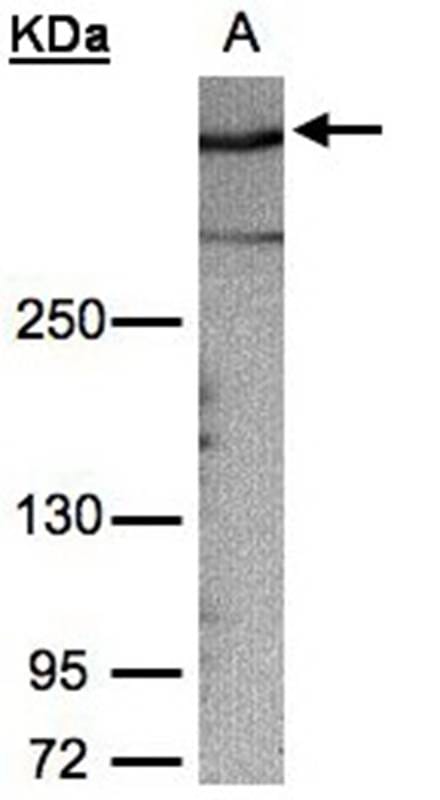 Sample (30ug whole cell lysate) HeLa S35% SDS PAGE Primary antibody diluted at 1: 1000