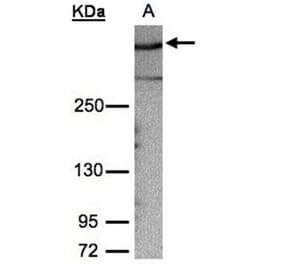 AKAP12 antibody from Signalway Antibody (22020) - Antibodies.com