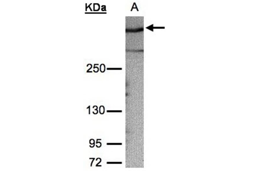 AKAP12 antibody from Signalway Antibody (22020) - Antibodies.com