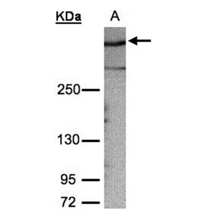 AKAP12 antibody from Signalway Antibody (22020) - Antibodies.com