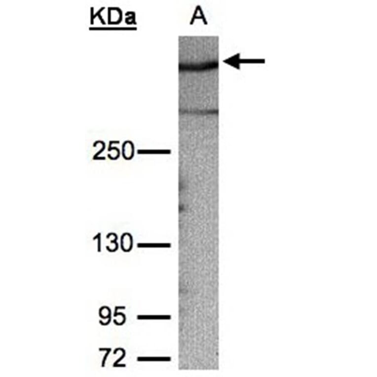 AKAP12 antibody from Signalway Antibody (22020) - Antibodies.com