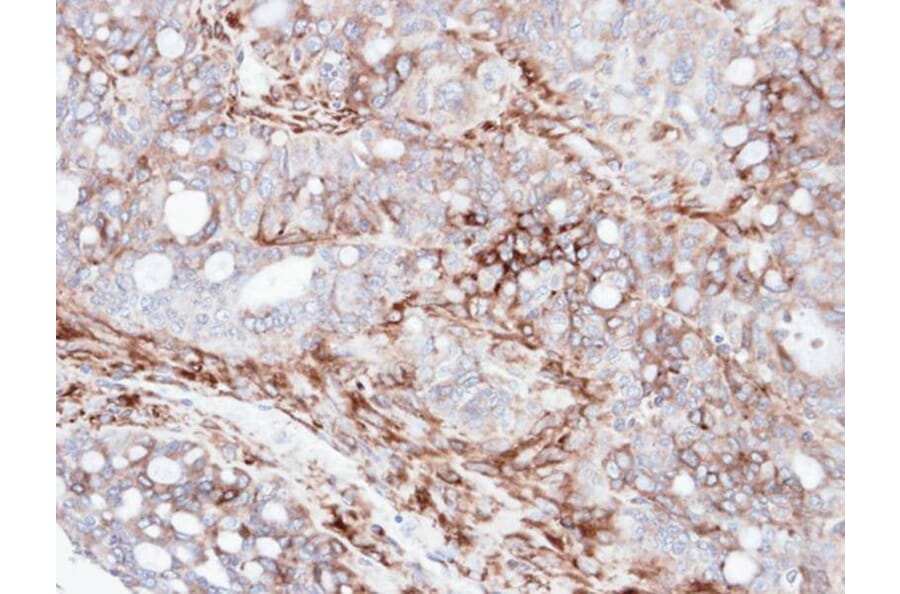 Immunohistochemistry - AKAP12 antibody from Signalway Antibody (22020) - Antibodies.com