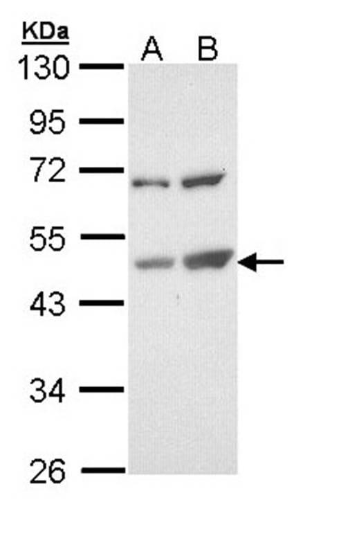 Sample (30 µg of whole cell lysate)  Molt-4 B: Raji 10% SDS PAGE Primary antibody diluted at 1: 1000
