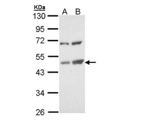 TSPYL1 antibody from Signalway Antibody (22025) - Antibodies.com