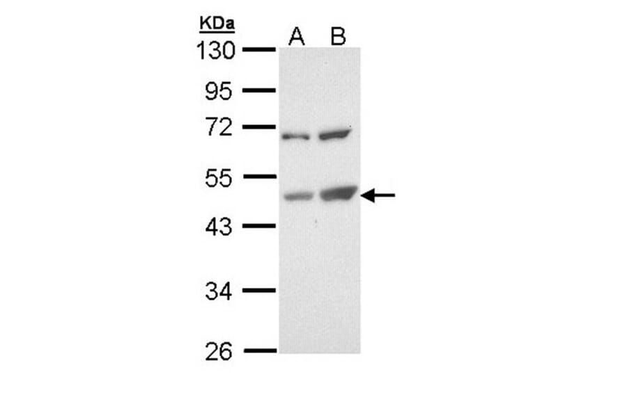 TSPYL1 antibody from Signalway Antibody (22025) - Antibodies.com