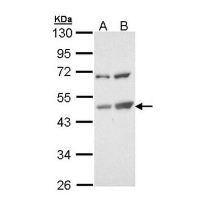 TSPYL1 antibody from Signalway Antibody (22025) - Antibodies.com