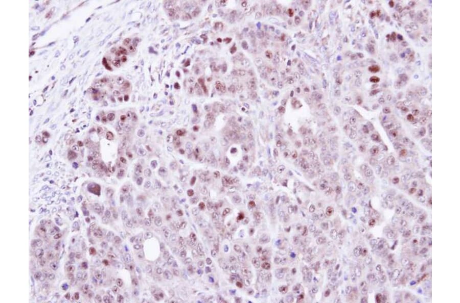 Immunohistochemistry - TSPYL1 antibody from Signalway Antibody (22025) - Antibodies.com
