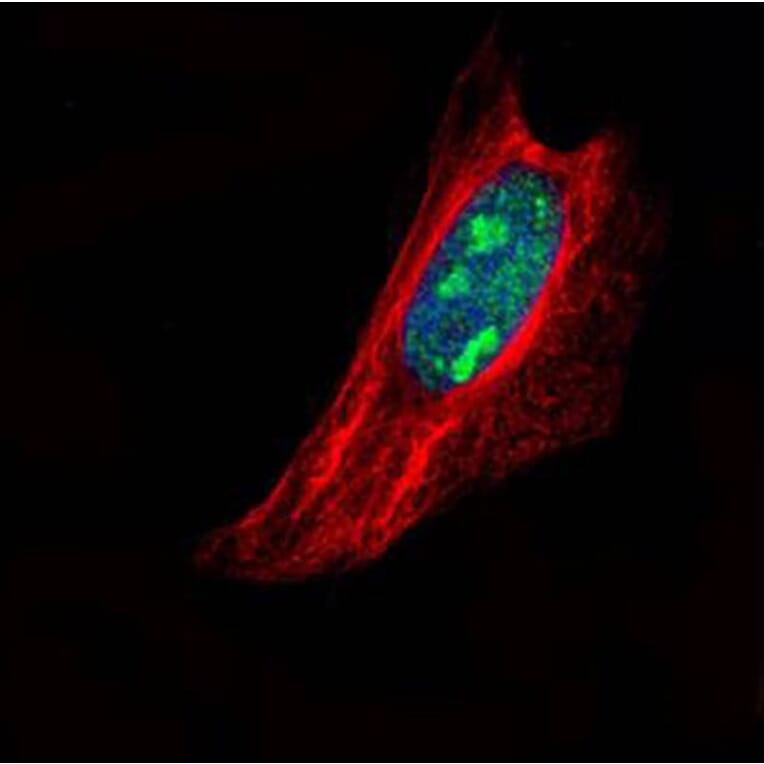 TSPYL1 antibody from Signalway Antibody (22025) - Antibodies.com