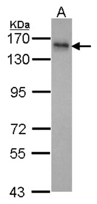 Sample (30 µg of whole cell lysate)  Hela 7.5% SDS PAGE INPP5F antibody diluted at 1: 1000