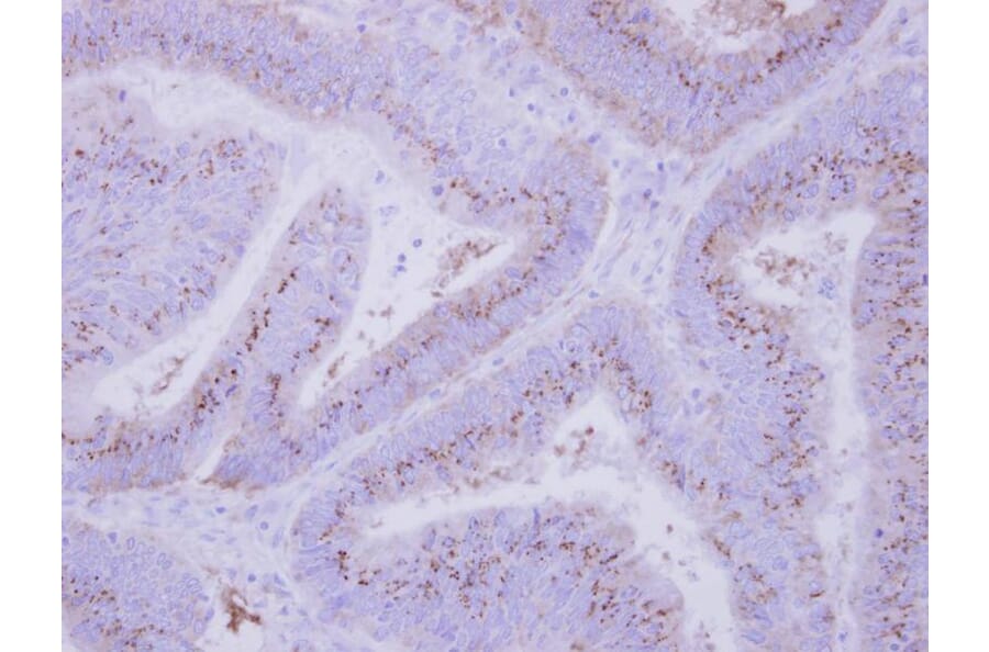 Immunohistochemistry - INPP5F antibody from Signalway Antibody (22043) - Antibodies.com