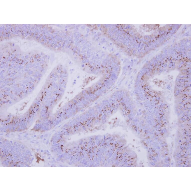 Immunohistochemistry - INPP5F antibody from Signalway Antibody (22043) - Antibodies.com