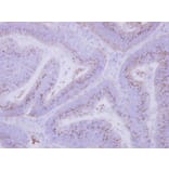 Immunohistochemistry - INPP5F antibody from Signalway Antibody (22043) - Antibodies.com