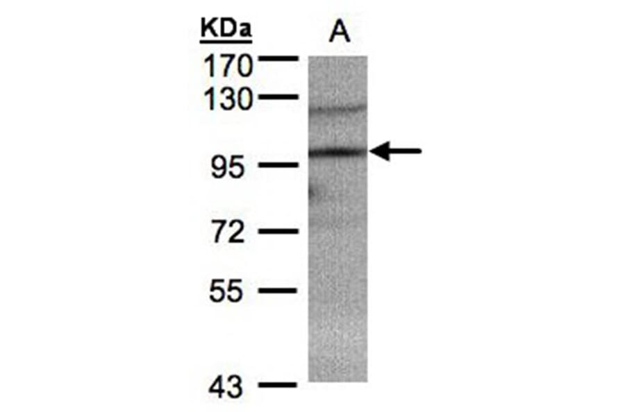 TRIM37 antibody from Signalway Antibody (22055) - Antibodies.com