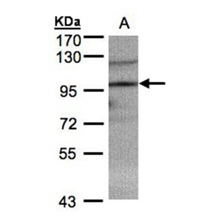 TRIM37 antibody from Signalway Antibody (22055) - Antibodies.com