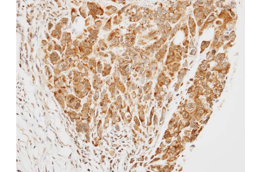 Immunohistochemistry - TRIM37 antibody from Signalway Antibody (22055) - Antibodies.com