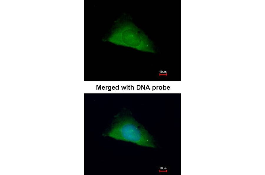 Immunofluorescence - TRIM37 antibody from Signalway Antibody (22055) - Antibodies.com