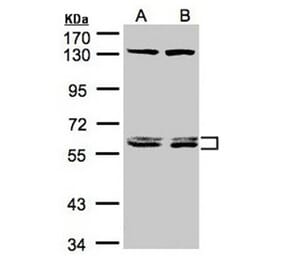 DNAJC7 antibody from Signalway Antibody (22078) - Antibodies.com