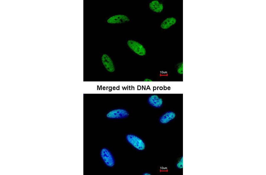 Immunofluorescence - DNAJC7 antibody from Signalway Antibody (22078) - Antibodies.com