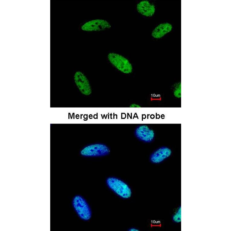 Immunofluorescence - DNAJC7 antibody from Signalway Antibody (22078) - Antibodies.com