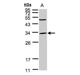 Peflin antibody from Signalway Antibody (22097) - Antibodies.com