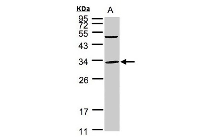 Peflin antibody from Signalway Antibody (22097) - Antibodies.com