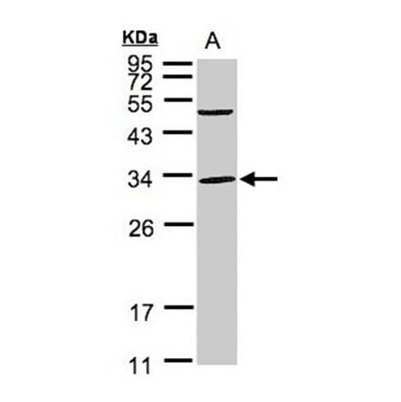 Peflin antibody from Signalway Antibody (22097) - Antibodies.com